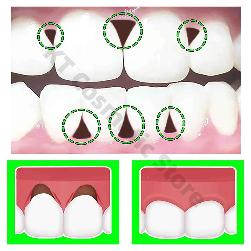 Gum Repair Toothpaste & Gel Serum – Relieves Sensitivity, Recession & Bad Breath
