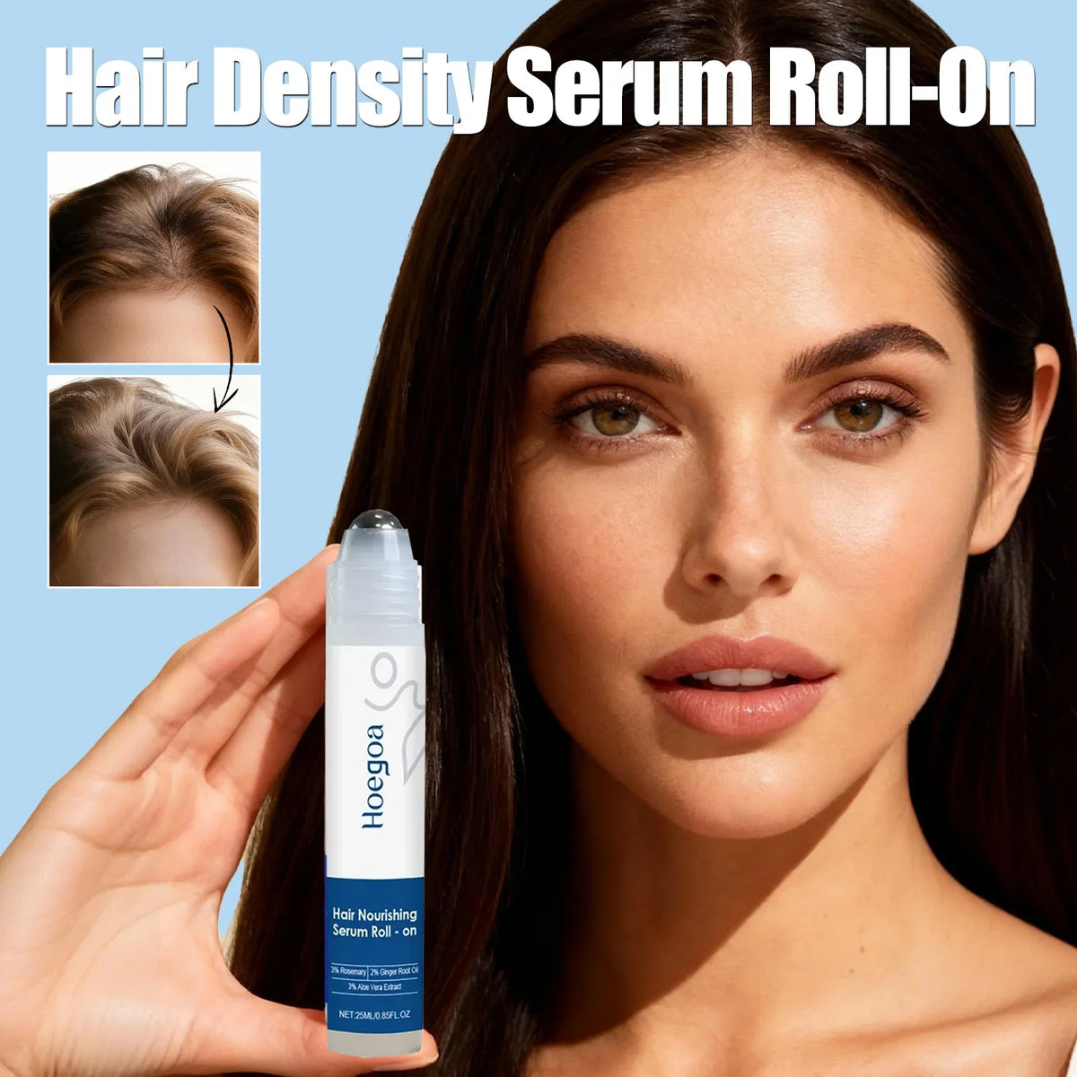 Ginger & Rosemary Hair Growth Oil Roller – Scalp Treatment Serum for Hair Loss & Thinning