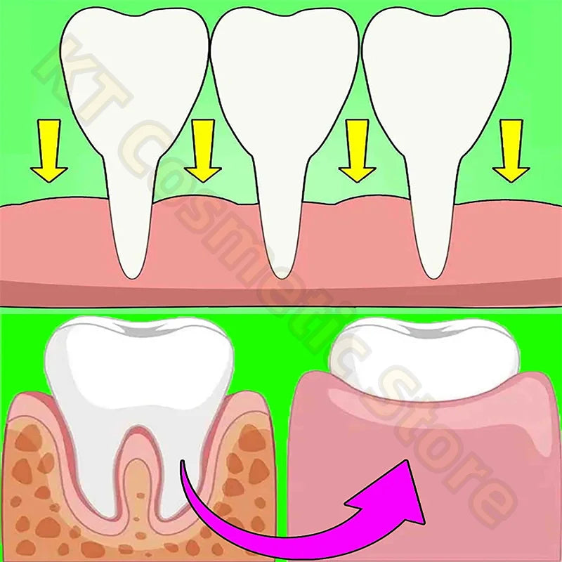 Gum Repair Toothpaste & Gel Serum – Relieves Sensitivity, Recession & Bad Breath
